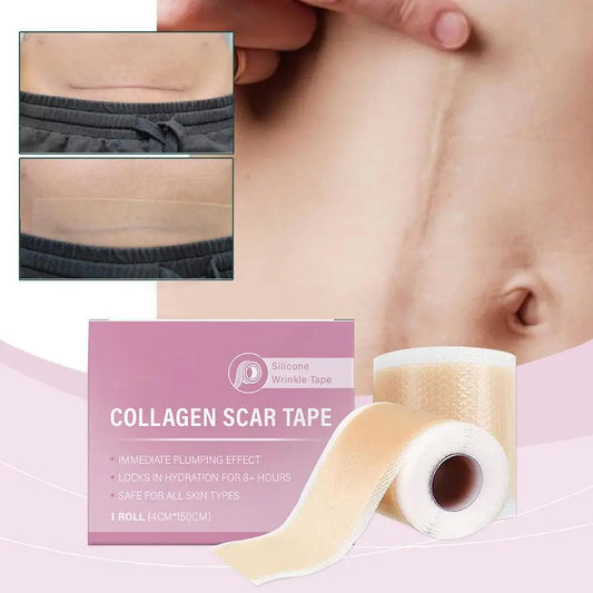 Hot Sale 1 Roll Silicone Scar Sheet Effective Scar Waterproof Breathable Painless Scar Repair Tape Roll Beauty Sticker 2025 New