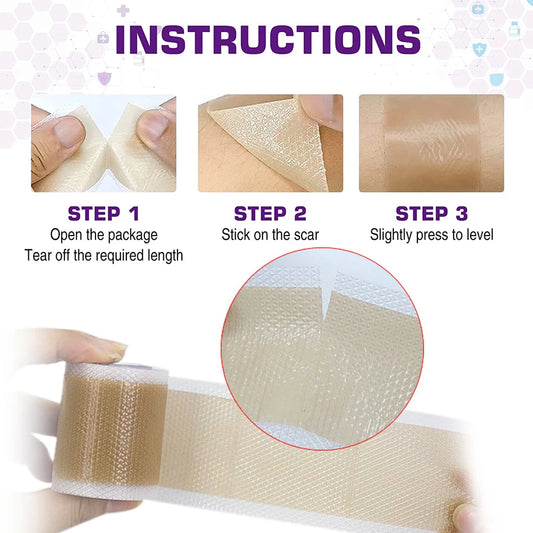 1 Roll Silicone Scar Sheets - Medical Grade, Reusable Scar Tape for Keloid, C-Section, Surgery, Burn, Acne - Waterproof, Latex-F