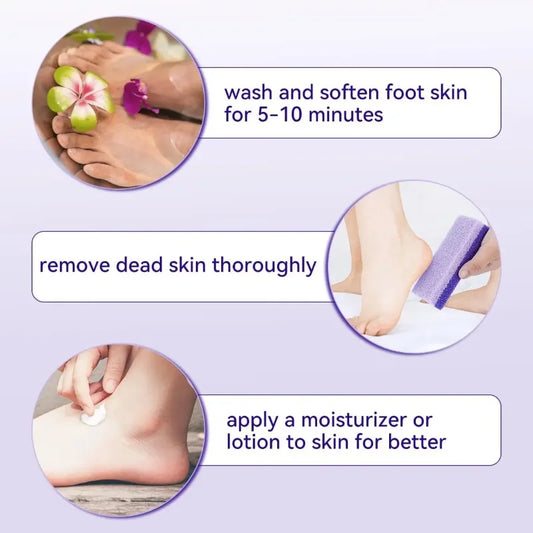 Foot Care Pumice Stone for Feet 2in1 Double Sided Foot Pumice Stone Dead Skin Scrubber for Feet Hands and Body Dead Skin Remover