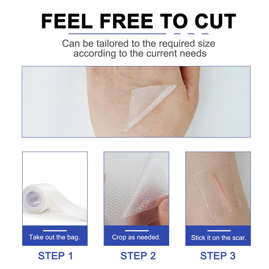 1 Roll=4cm X 3m Invisible Silicone Scar Sheets Self-Adhesive Scar Cover Tape Reusable and Effective Skin Care Strips
