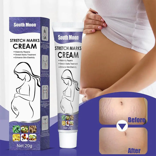 Remove Pregnancy Scars Acne Cream Stretch Marks Treatment Maternity Repair Anti-Aging Anti-Winkles Firming Body Creams