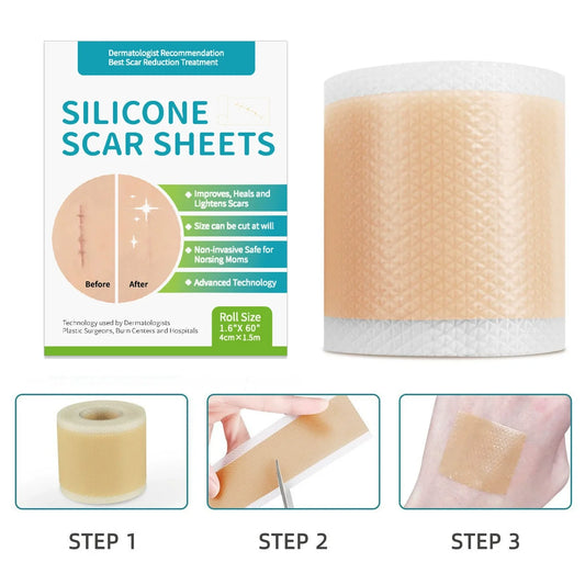 1 Roll = 4cm X 1.5m Silicone Scar Sheets Self-Adhesive Scar Cover Tape Reusable Skin Care Strips