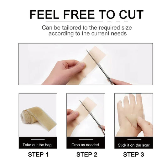 1 Roll = 4cm X 3m Silicone Scar Sheets Self-Adhesive Scar Cover Tape Reusable and Effective Skin Care Strips