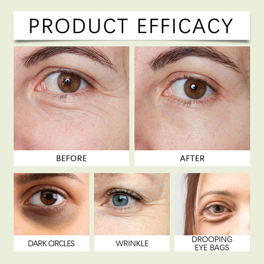 HOYGI Collagen Eye Serum Anti Puffiness Eye Bags Anti Dark Circles Moisturizing Tightening Reduce Fine Lines Skin Care Roller
